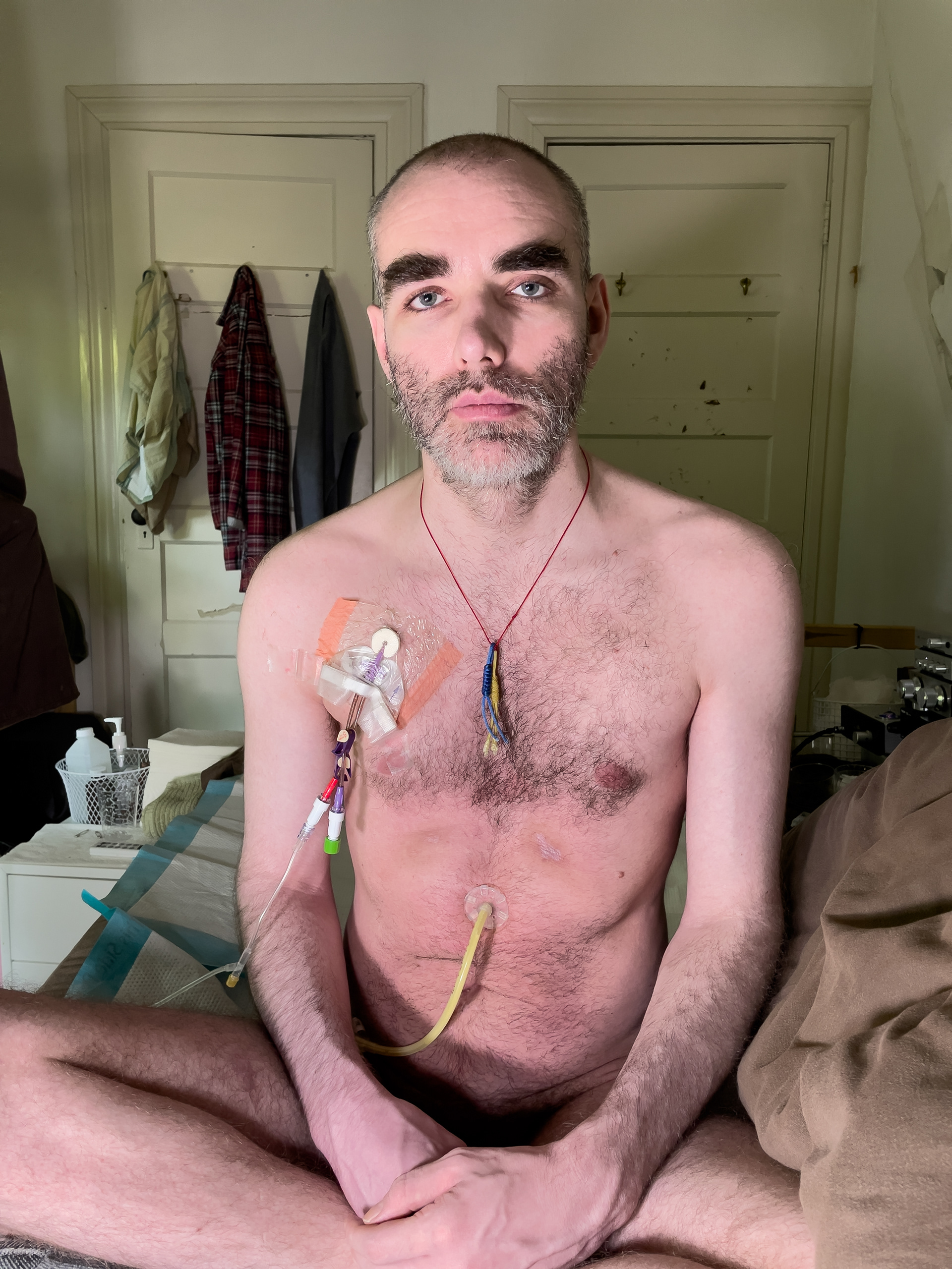 ME/CFS uncensored.